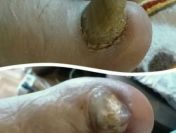 Leczniczy pedicure dla seniorów, pedicure kosmetyczny, manicure, Podolog,