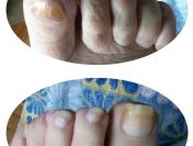 Leczniczy pedicure dla seniorów, pedicure kosmetyczny, manicure, Podolog,